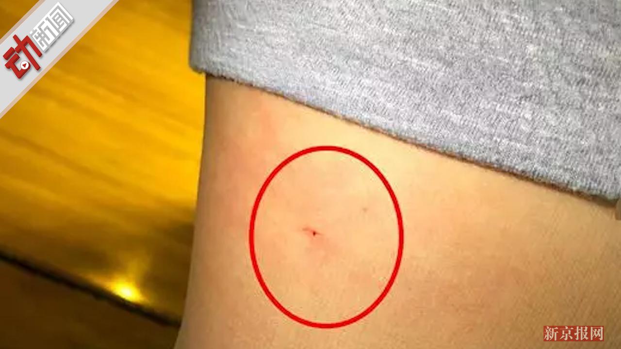 星级酒店床上有根立起的针 情侣出游入住 女生大腿被扎出血!